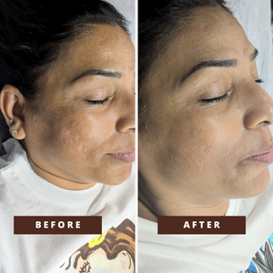 Smile Transformation 11